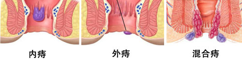 药物人流、人流术前指导、人流护理图片